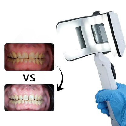 Kit de Iluminación M95 Dental con Control Electrónico para Smartphone
