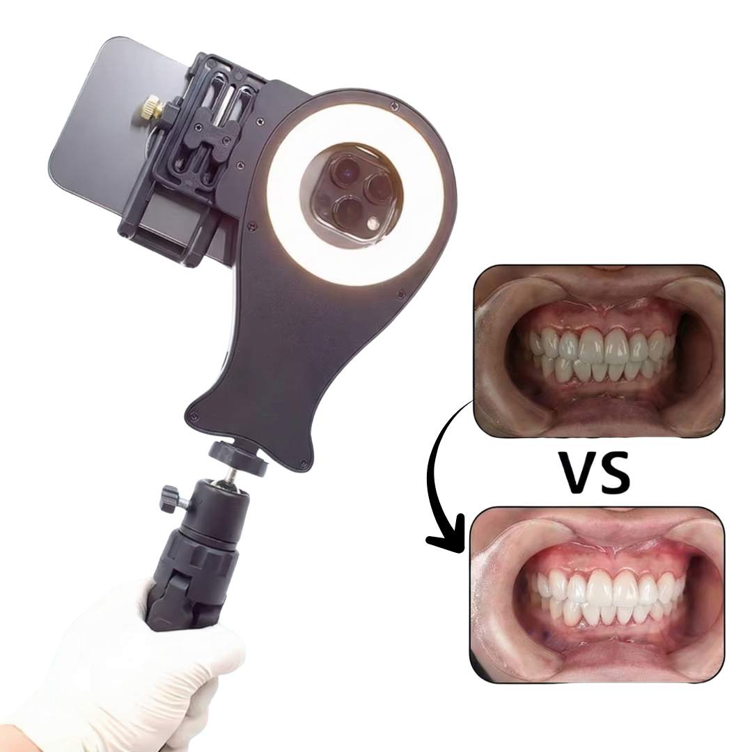 Soporte para Fotografía Oral V4 – compatible con cualqu usado en clínica dental